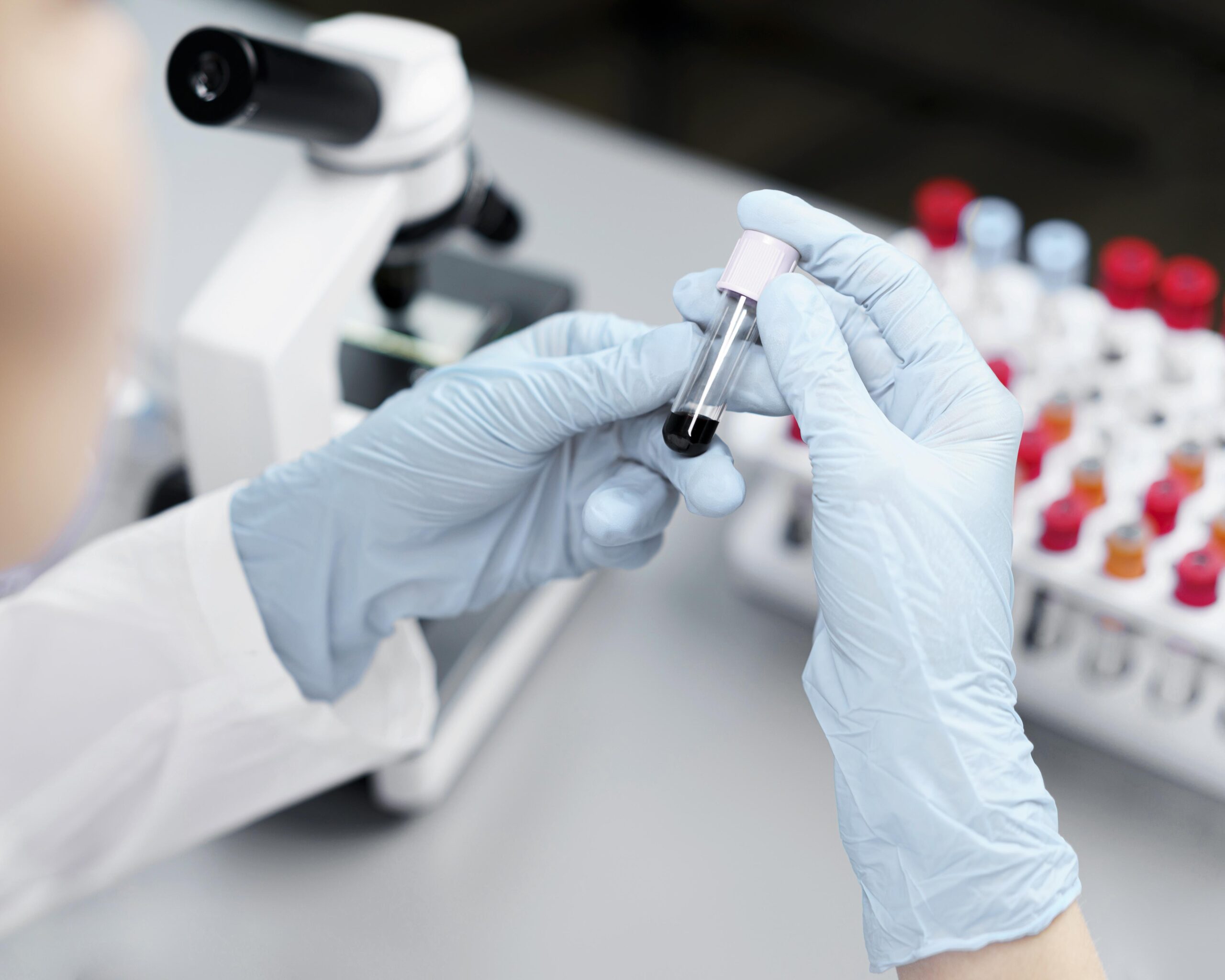 Role of Preimplantation Genetic Testing