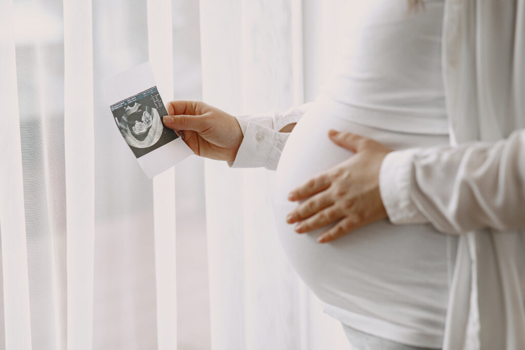 IVF Dubai