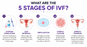 What are the 5 stages of ivf